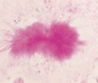 prion_1.gif