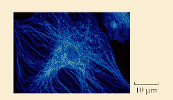 cmicrotubulos.jpg