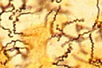 Treponema-pallidum.jpg