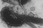 vivbrio-cholerae.jpg
